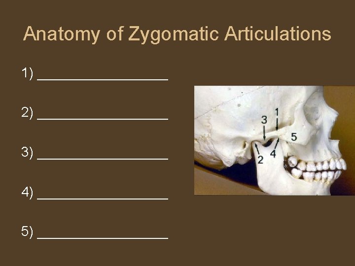 Anatomy of Zygomatic Articulations 1) _________ 2) _________ 3) _________ 4) _________ 5) _________