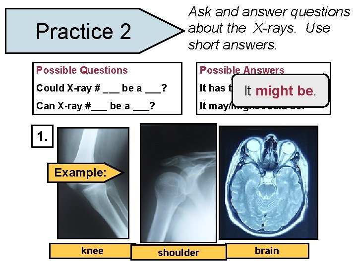 Ask and answer questions about the X-rays. Use short answers. Practice 2 Possible Questions