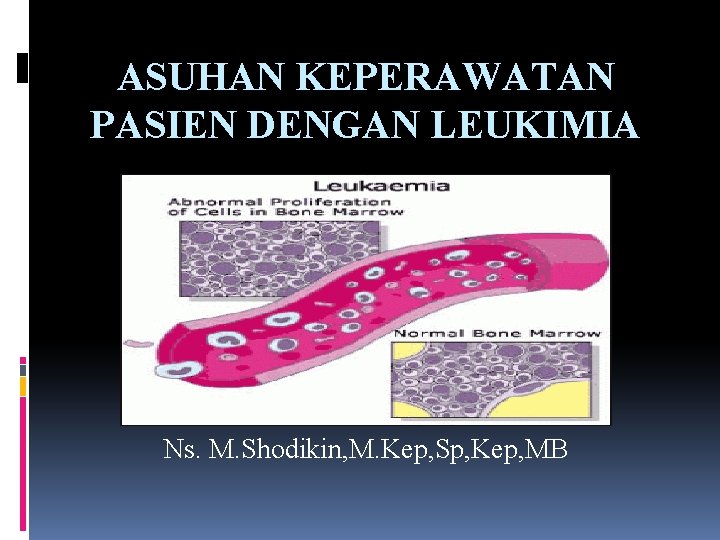 ASUHAN KEPERAWATAN PASIEN DENGAN LEUKIMIA Ns. M. Shodikin, M. Kep, Sp, Kep, MB 