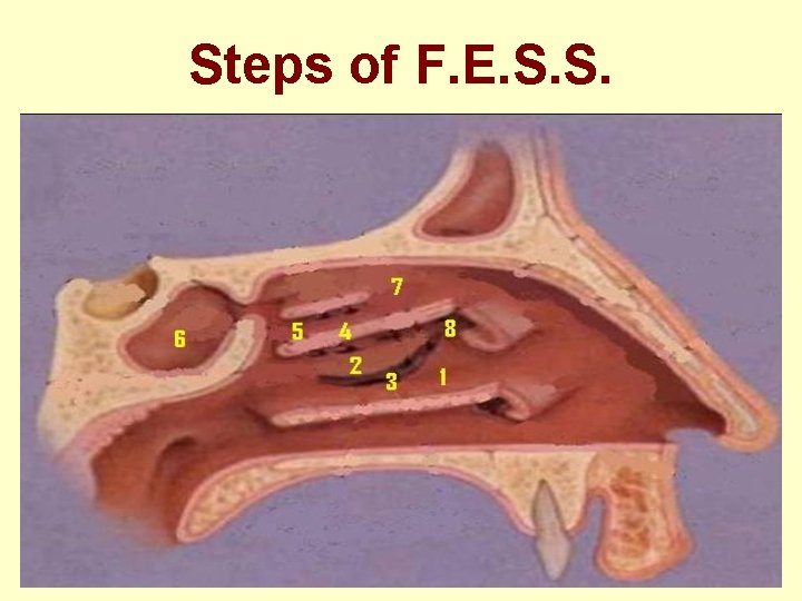 Steps of F. E. S. S. 