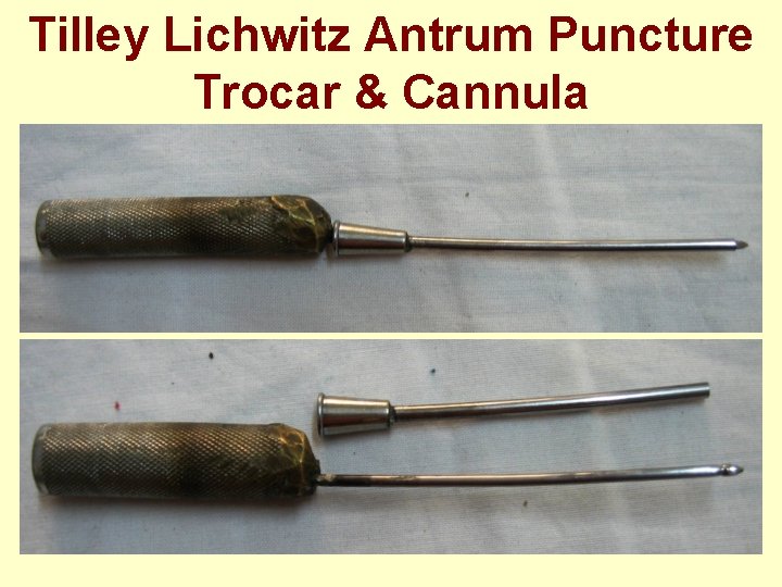 Tilley Lichwitz Antrum Puncture Trocar & Cannula 