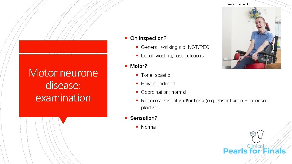 Source: bbc. co. uk § On inspection? § General: walking aid, NGT/PEG § Local: