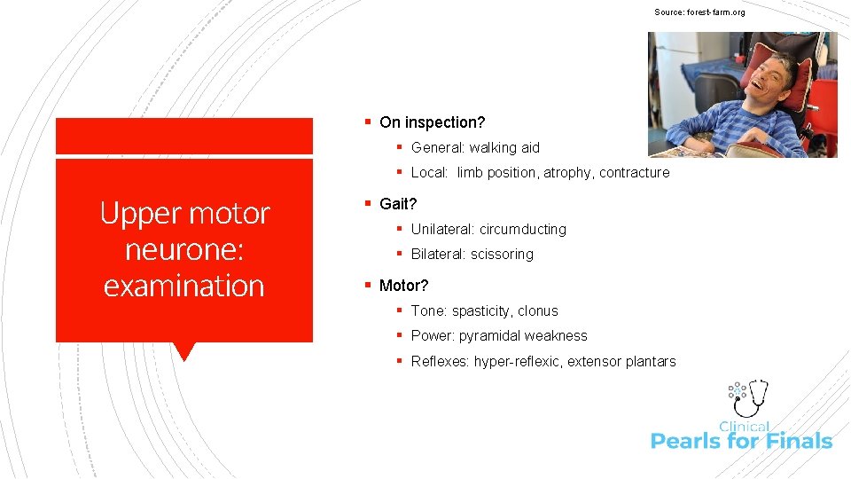 Source: forest-farm. org § On inspection? § General: walking aid § Local: limb position,