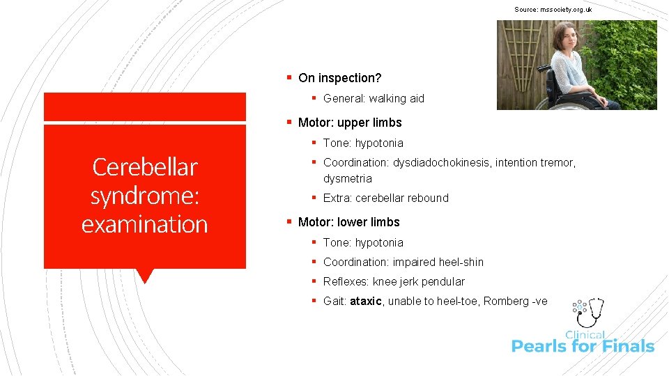 Source: mssociety. org. uk § On inspection? § General: walking aid § Motor: upper