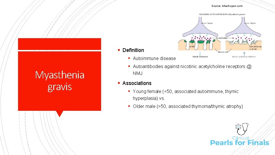Source: intechopen. com § Definition § Autoimmune disease Myasthenia gravis § Autoantibodies against nicotinic