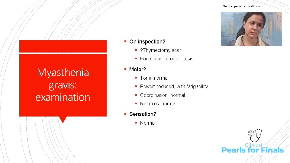 Source: pediatriconcall. com § On inspection? § ? Thymectomy scar § Face: head droop,