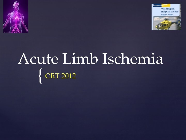 Acute Limb Ischemia { CRT 2012 