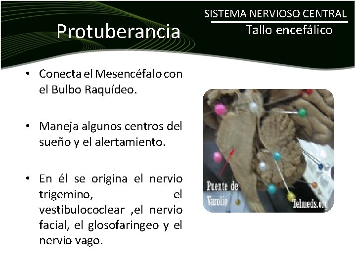 Protuberancia • Conecta el Mesencéfalo con el Bulbo Raquídeo. • Maneja algunos centros del
