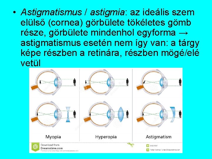 astigmatismus jelentése száj látásélesség diagram