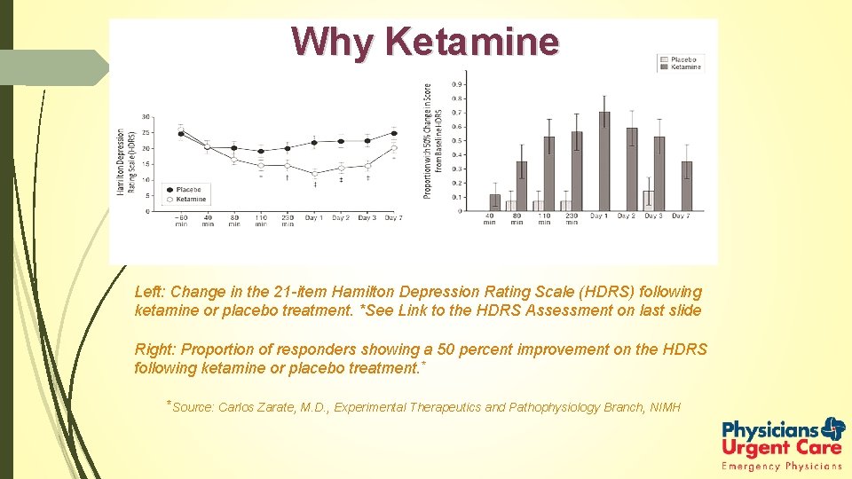 Why Ketamine Left: Change in the 21 -item Hamilton Depression Rating Scale (HDRS) following
