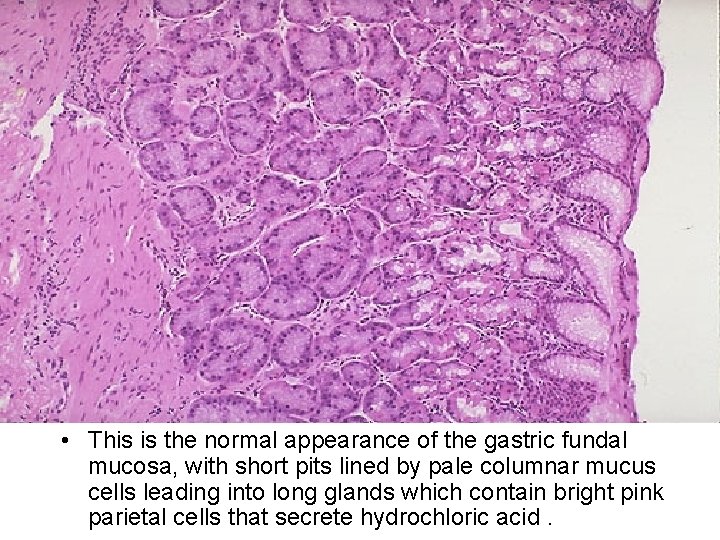  • This is the normal appearance of the gastric fundal mucosa, with short