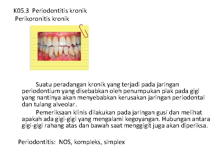 K 05. 3 Periodontitis kronik Perikoronitis kronik Suatu peradangan kronik yang terjadi pada jaringan