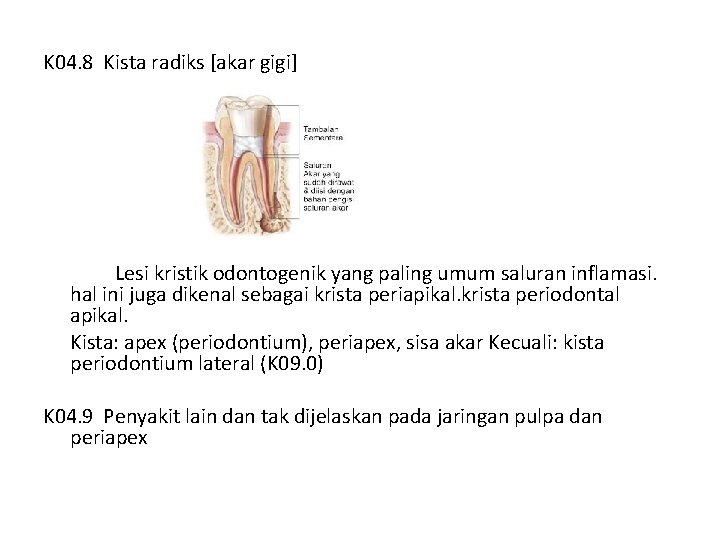 K 04. 8 Kista radiks [akar gigi] Lesi kristik odontogenik yang paling umum saluran