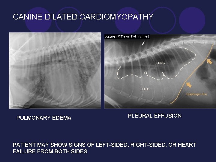 CANINE DILATED CARDIOMYOPATHY PULMONARY EDEMA PLEURAL EFFUSION PATIENT MAY SHOW SIGNS OF LEFT-SIDED, RIGHT-SIDED,