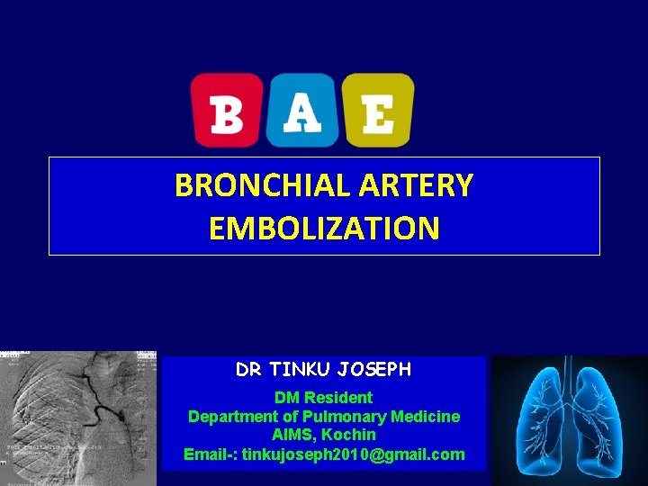 BRONCHIAL ARTERY EMBOLIZATION DR TINKU JOSEPH DM Resident Department of Pulmonary Medicine AIMS, Kochin