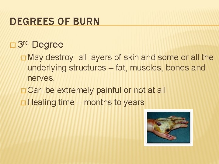 DEGREES OF BURN � 3 rd Degree � May destroy all layers of skin