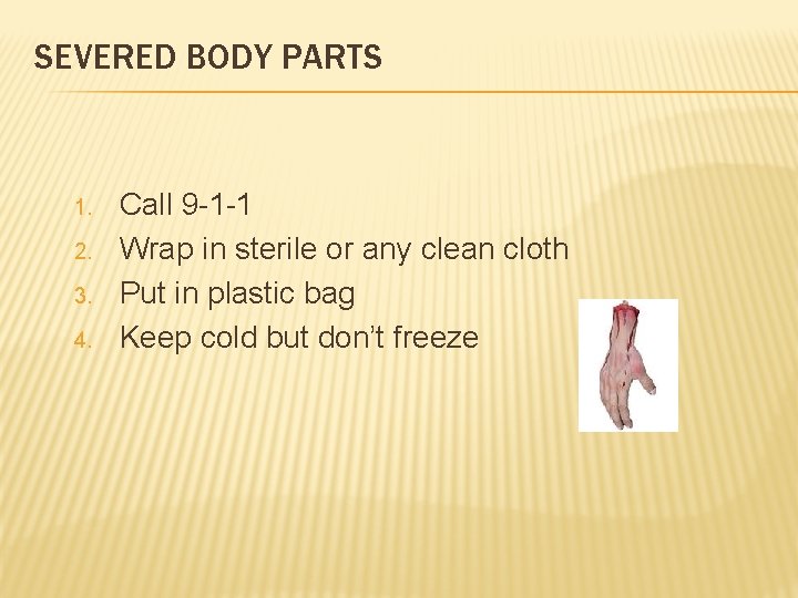 SEVERED BODY PARTS 1. 2. 3. 4. Call 9 -1 -1 Wrap in sterile