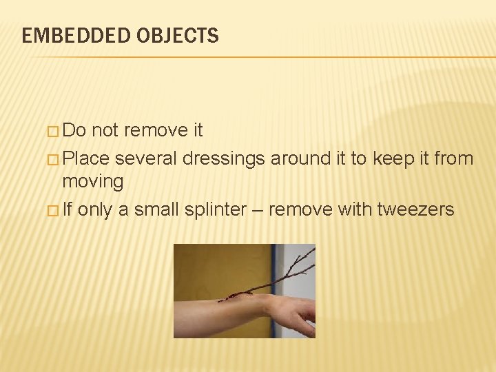 EMBEDDED OBJECTS � Do not remove it � Place several dressings around it to
