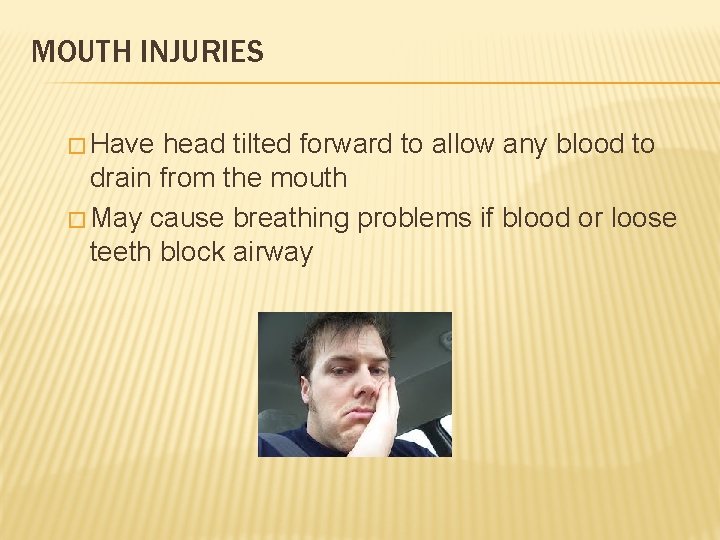 MOUTH INJURIES � Have head tilted forward to allow any blood to drain from
