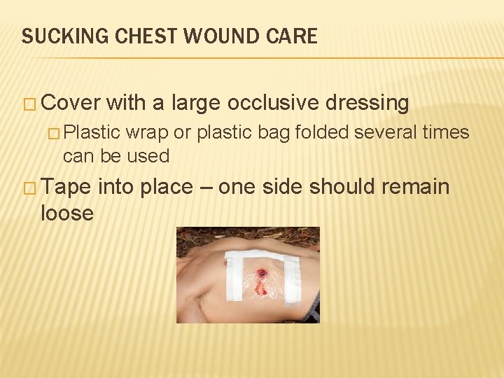 SUCKING CHEST WOUND CARE � Cover with a large occlusive dressing � Plastic wrap