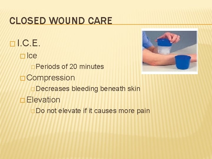 CLOSED WOUND CARE � I. C. E. � Ice � Periods of 20 minutes