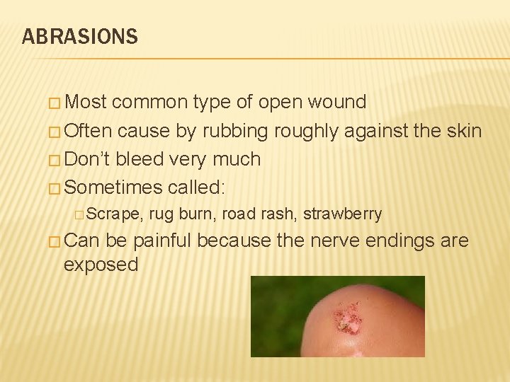 ABRASIONS � Most common type of open wound � Often cause by rubbing roughly