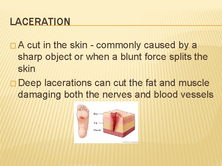 LACERATION �A cut in the skin - commonly caused by a sharp object or