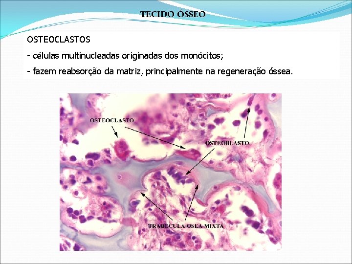 TECIDO ÓSSEO OSTEOCLASTOS - células multinucleadas originadas dos monócitos; - fazem reabsorção da matriz,