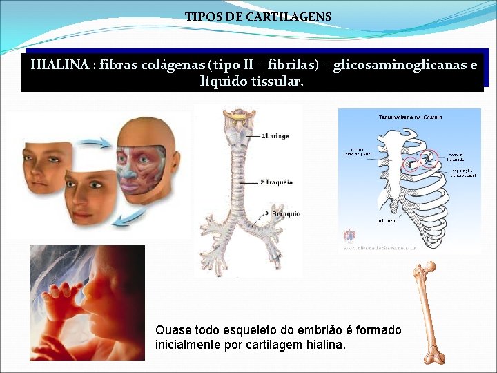 TIPOS DE CARTILAGENS HIALINA : fibras colágenas (tipo II – fibrilas) + glicosaminoglicanas e