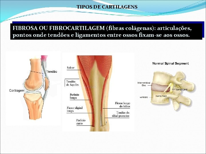 TIPOS DE CARTILAGENS FIBROSA OU FIBROCARTILAGEM (fibras colágenas): articulações, pontos onde tendões e ligamentos