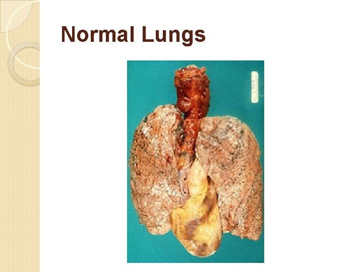 Normal Lungs 