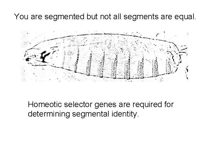 You are segmented but not all segments are equal. Homeotic selector genes are required
