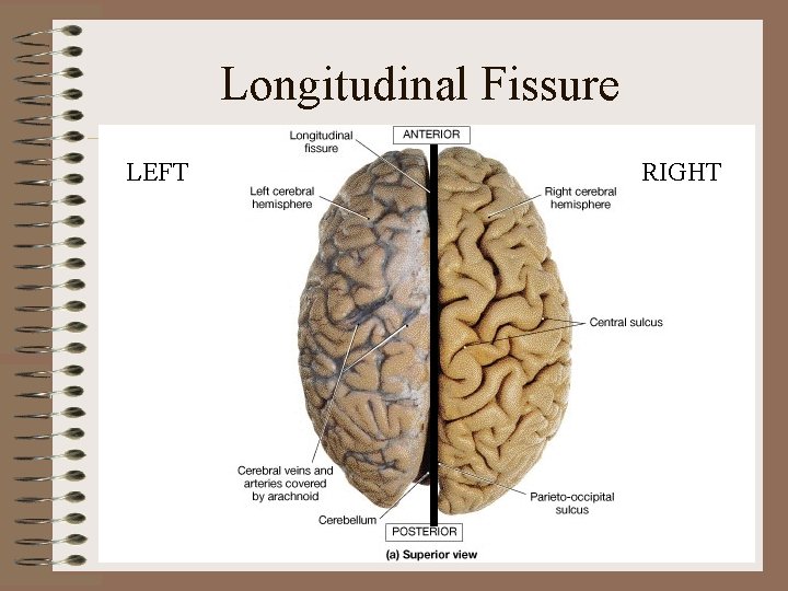 Longitudinal Fissure LEFT RIGHT Longitudinal Fissure LEFT RIGHT