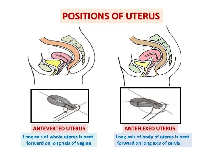 POSITIONS OF UTERUS ANTEVERTED UTERUS Long axis of whole uterus is bent forward on