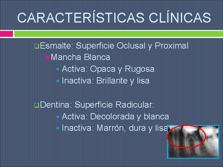 CARACTERÍSTICAS CLÍNICAS q. Esmalte: Superficie Oclusal y Proximal Mancha Blanca § Activa: Opaca y