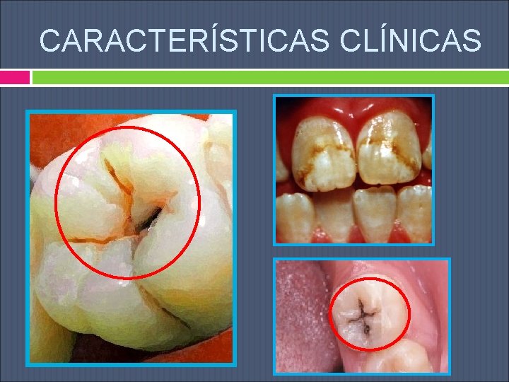 CARACTERÍSTICAS CLÍNICAS 