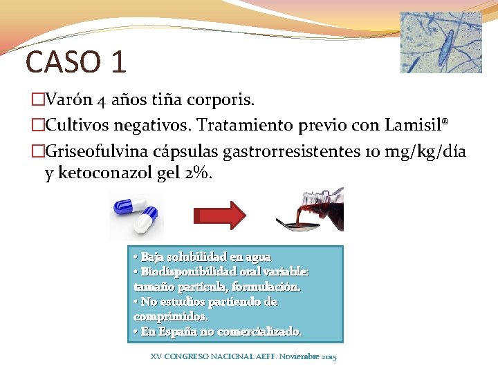 CASO 1 �Varón 4 años tiña corporis. �Cultivos negativos. Tratamiento previo con Lamisil® �Griseofulvina