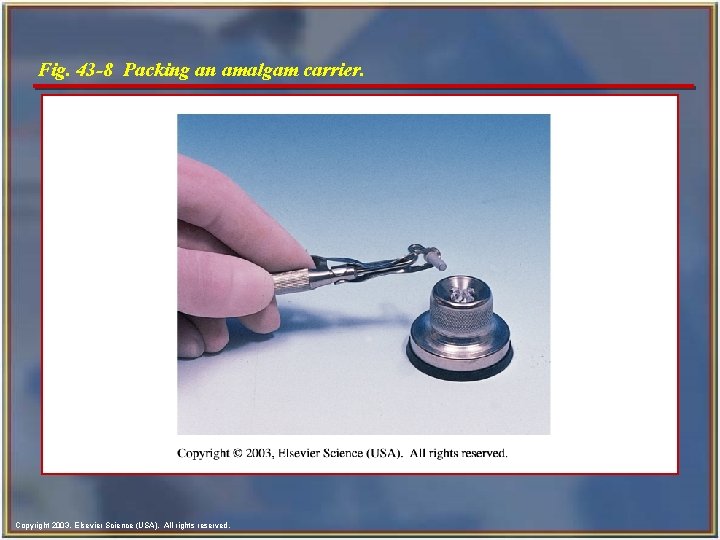 Fig. 43 -8 Packing an amalgam carrier. Copyright 2003, Elsevier Science (USA). All rights