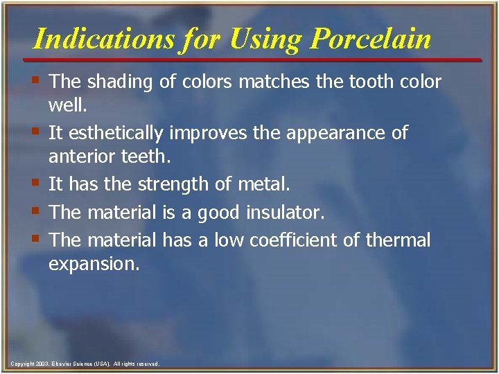 Indications for Using Porcelain § The shading of colors matches the tooth color §