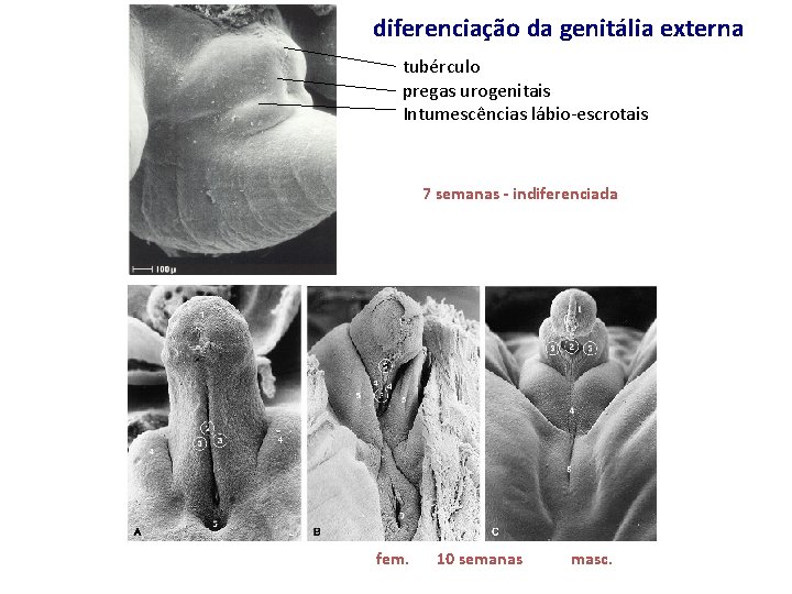 diferenciação da genitália externa tubérculo pregas urogenitais Intumescências lábio-escrotais 7 semanas - indiferenciada fem.