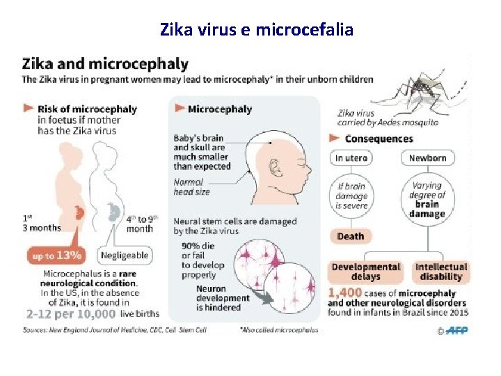 Zika virus e microcefalia 