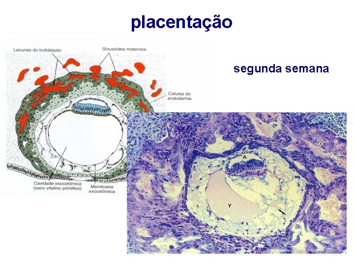 placentação segunda semana 