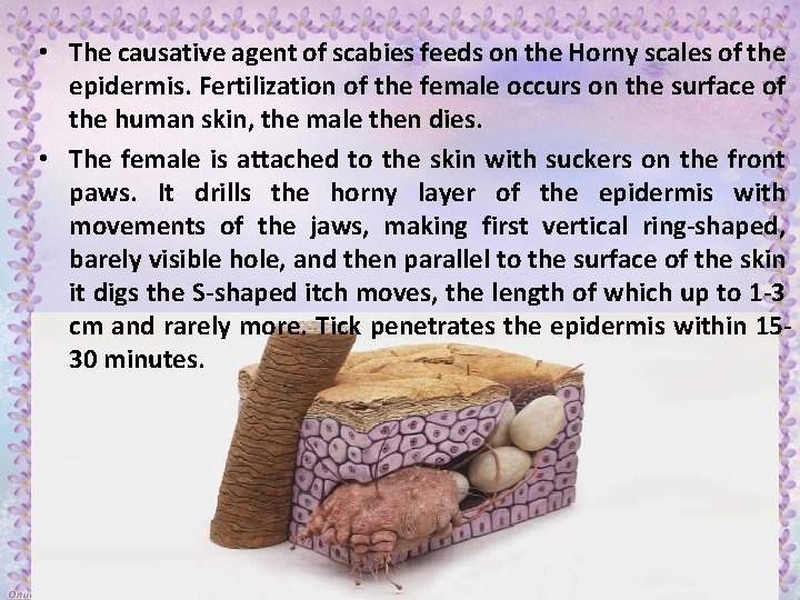  • The causative agent of scabies feeds on the Horny scales of the