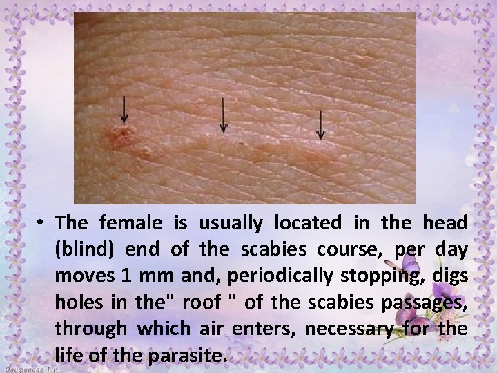  • The female is usually located in the head (blind) end of the