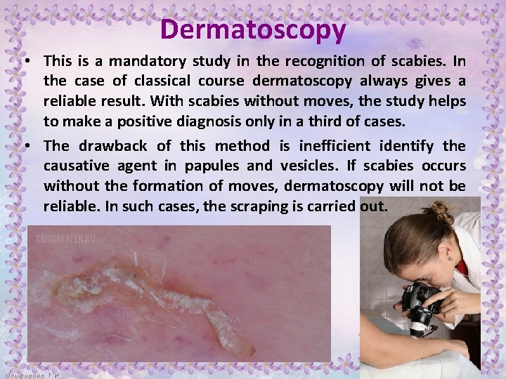 Dermatoscopy • This is a mandatory study in the recognition of scabies. In the