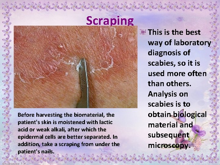 Scraping Before harvesting the biomaterial, the patient's skin is moistened with lactic acid or