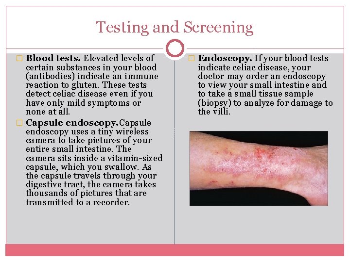 Testing and Screening � Blood tests. Elevated levels of certain substances in your blood