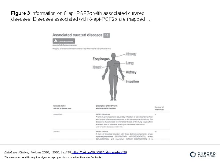 Figure 3 Information on 8 -epi-PGF 2α with associated curated diseases. Diseases associated with