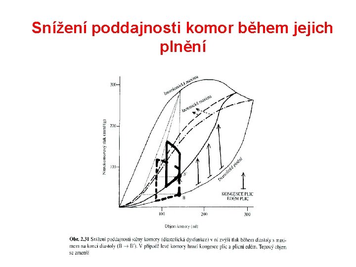 Snížení poddajnosti komor během jejich plnění 