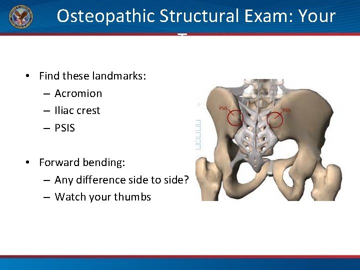 Osteopathic Structural Exam: Your Turn • Find these landmarks: – Acromion – Iliac crest